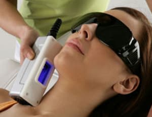 Фотоэпиляция